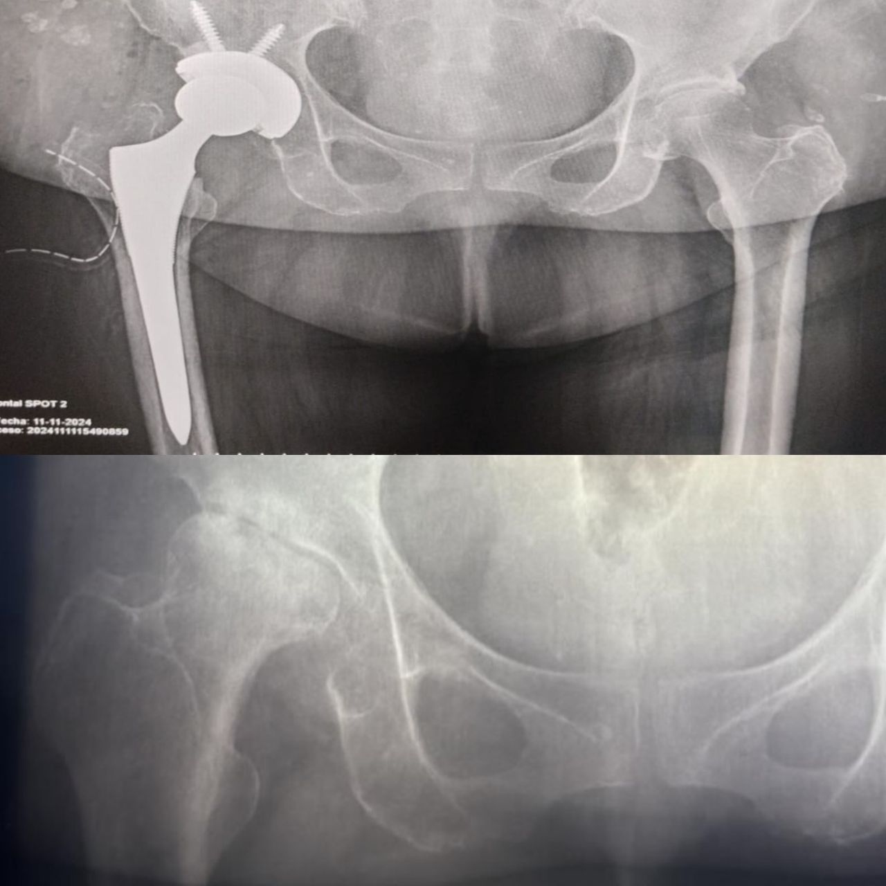 Elías Benjamín Preciado Tovar-1