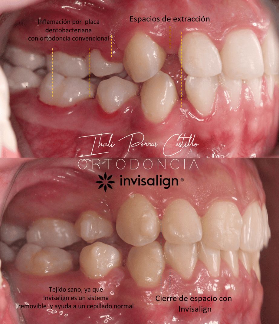 Ihali Porras Castillo-6