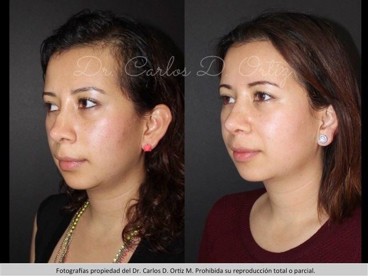 Carlos David Ortiz Moreno-30