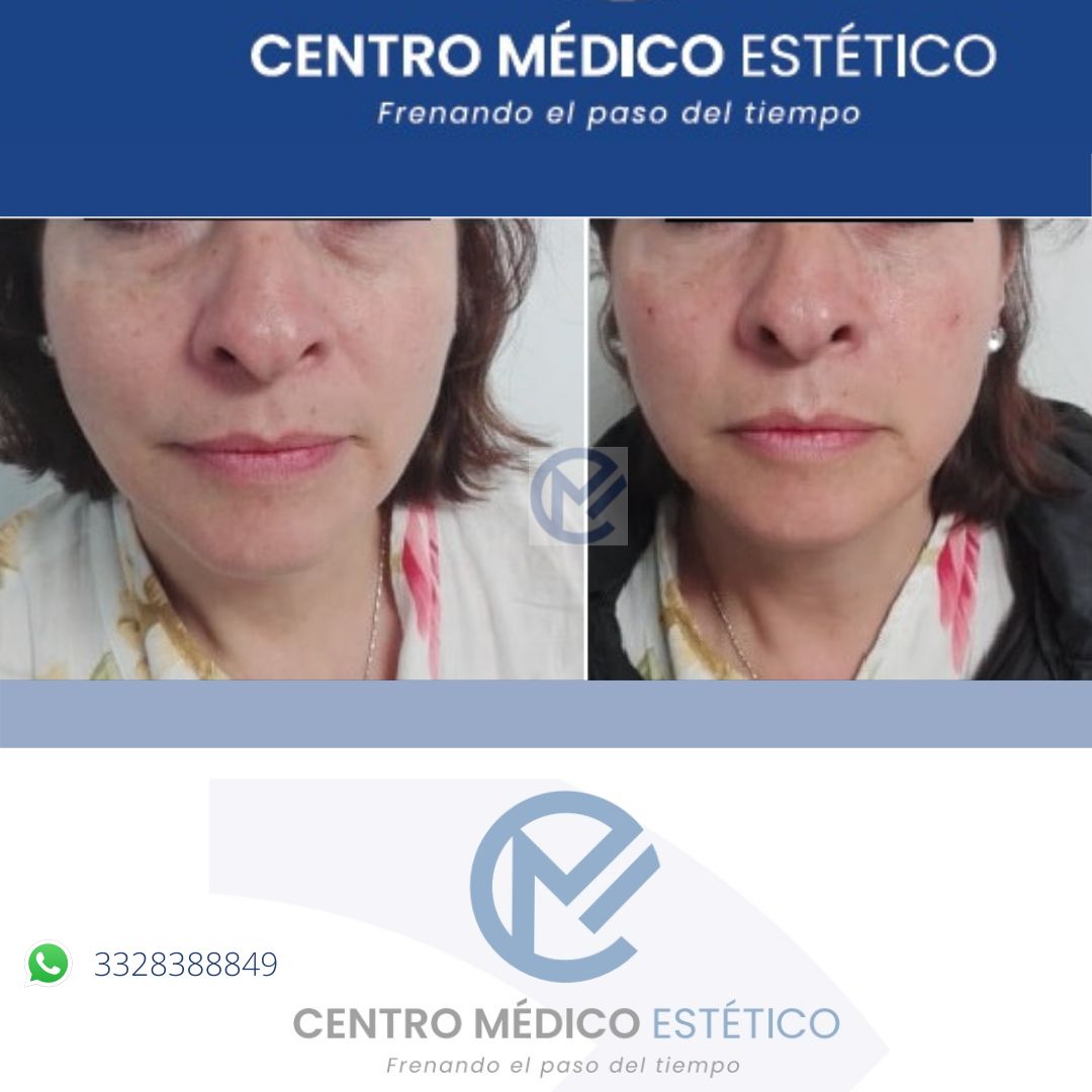 Sergio Alejandro Cerda Mendoza-10