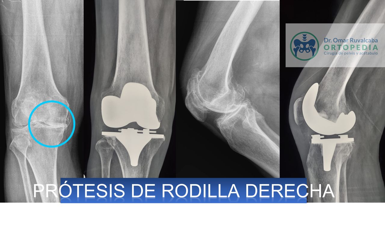 Omar Ruvalcaba Luna-18