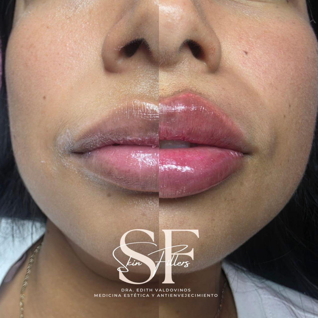 Edith Valdovinos Covarrubias-5