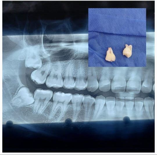 Leslie Michelle Galan Bahena-26