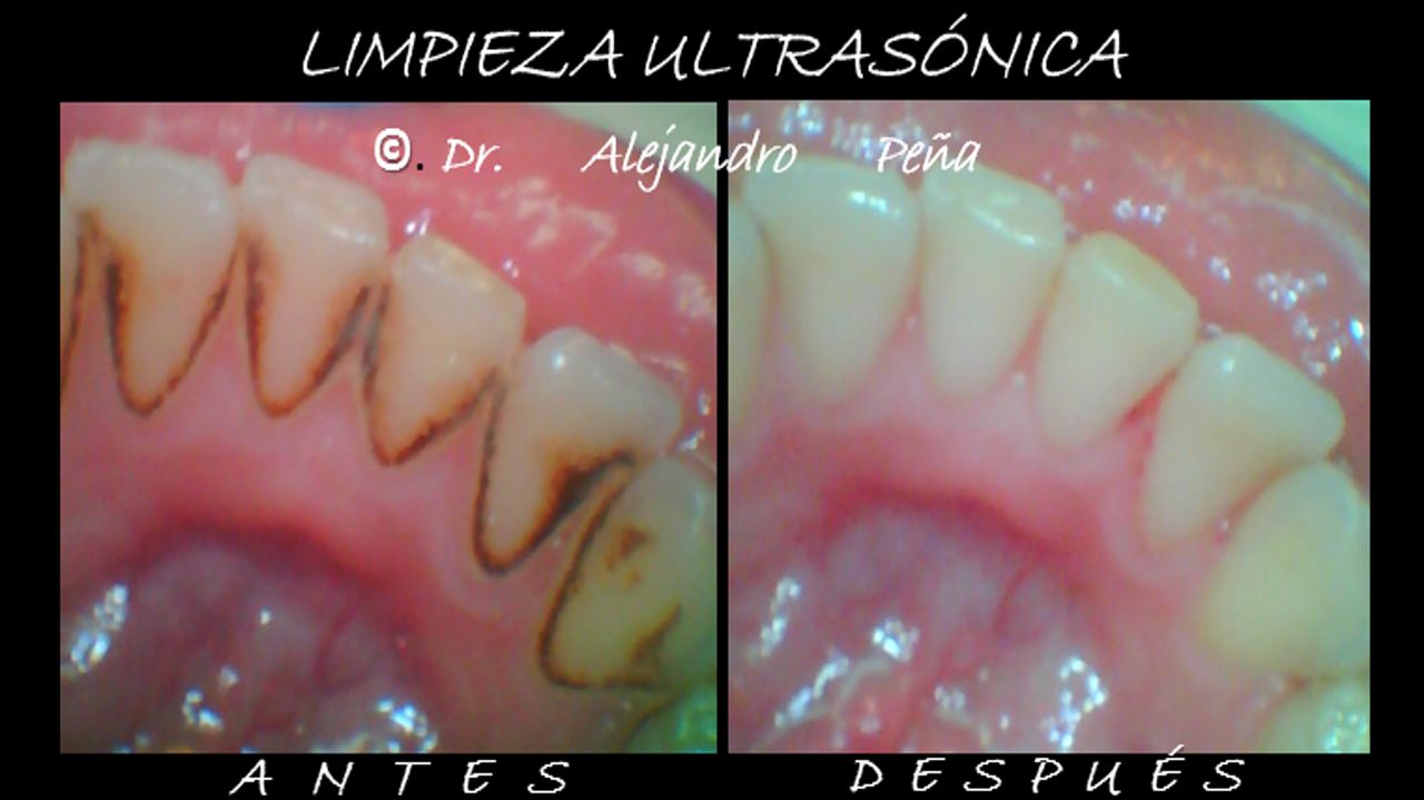 Alejandro Peña Vega-9