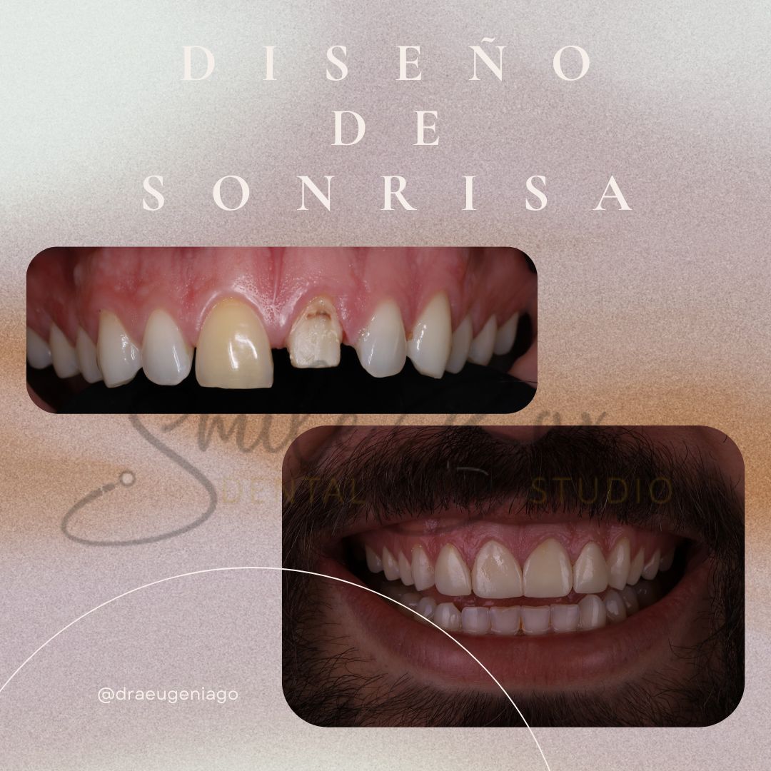 Eugenia Gaytán Olaguivel-3