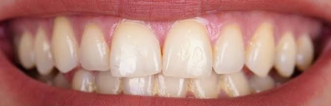 Emmanuel Pineda Herrera-0