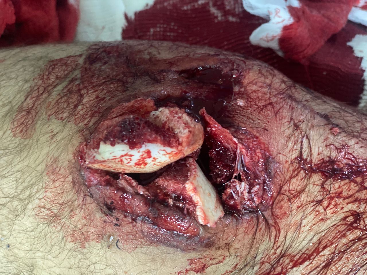 Francisco Sandoval Pérez-10