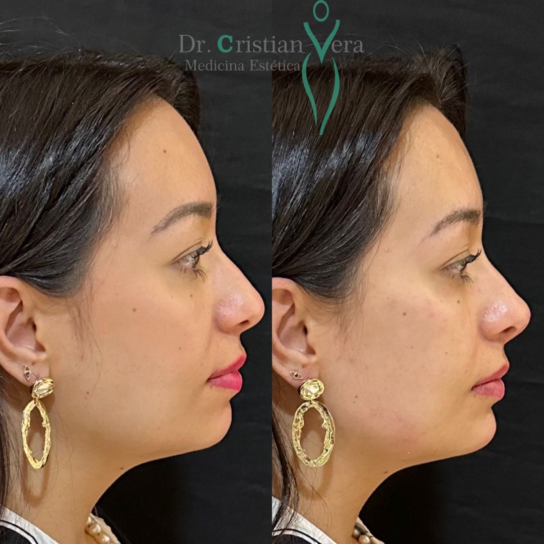 Cristian Eduardo Vera Nuño-4