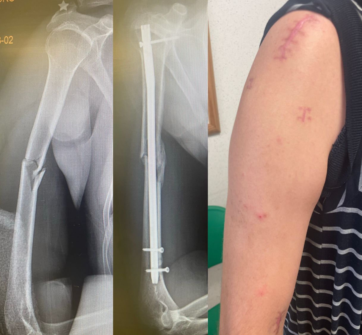 Diego Armando Contreras Rojas-16