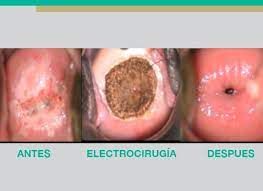 Erika Karina Fuentes Gutiérrez-5