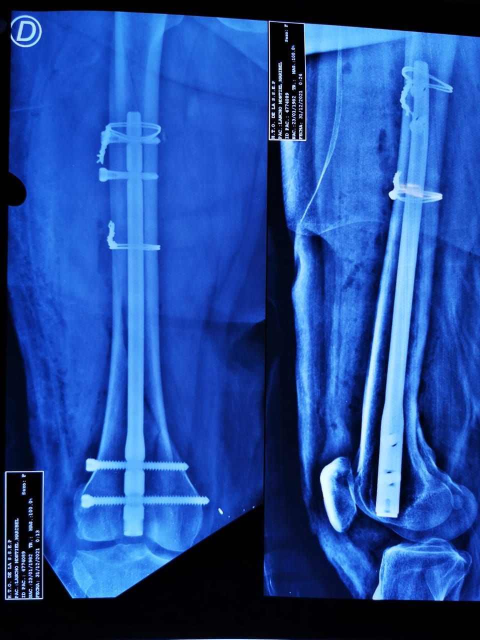 Jair Alejandro Valenzuela Torrano-1