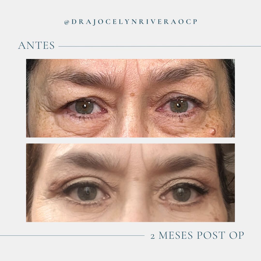 Ivonne Jocelyn Rivera Alvarado-3