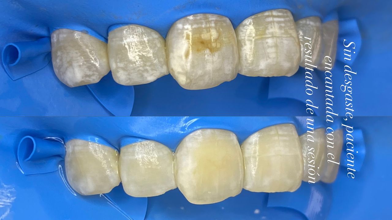 Luis Arellano De León-14