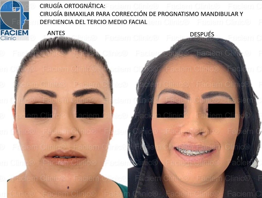 Arlen Colín Ordaz-9