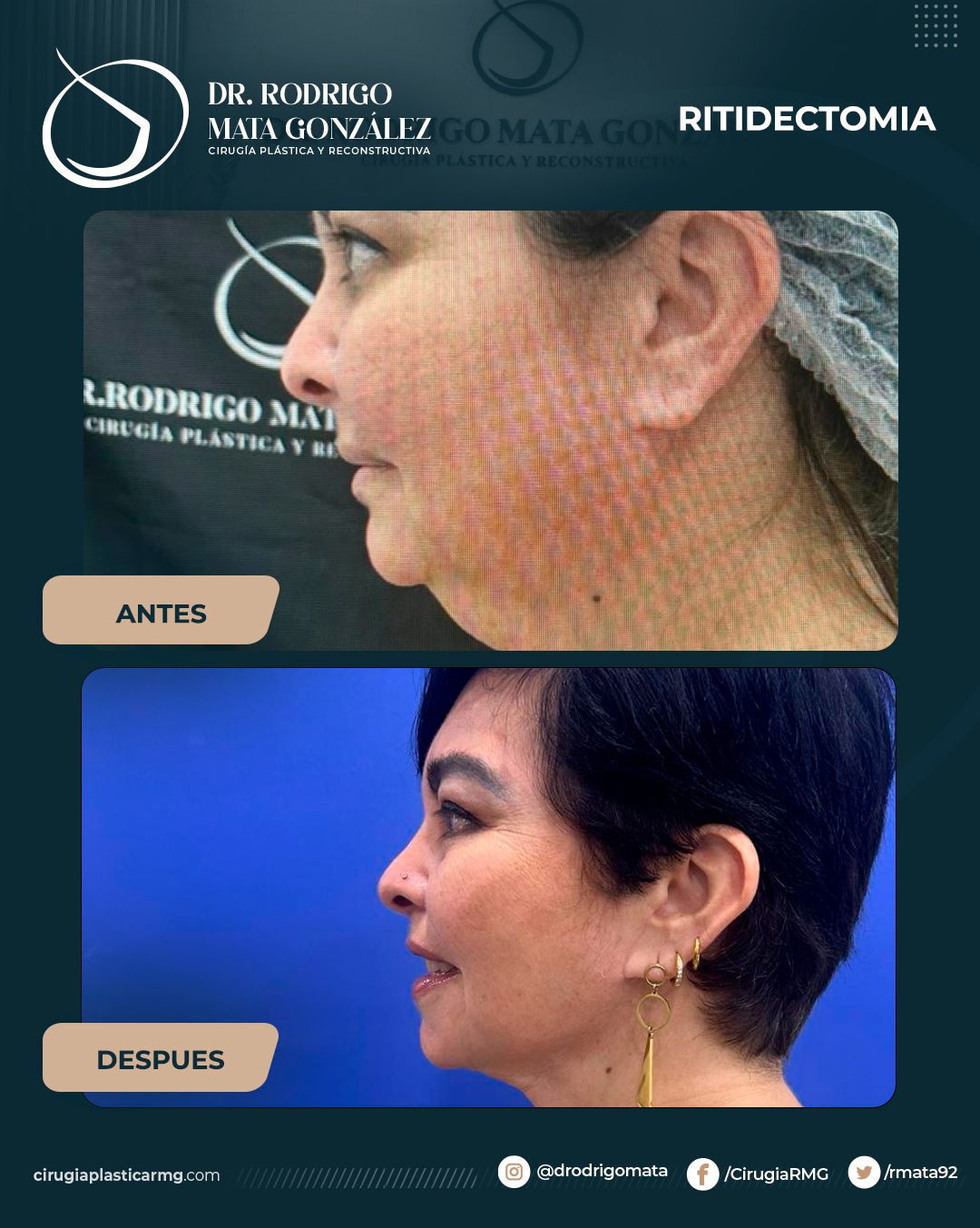 Rodrigo Mata Gonzalez-6