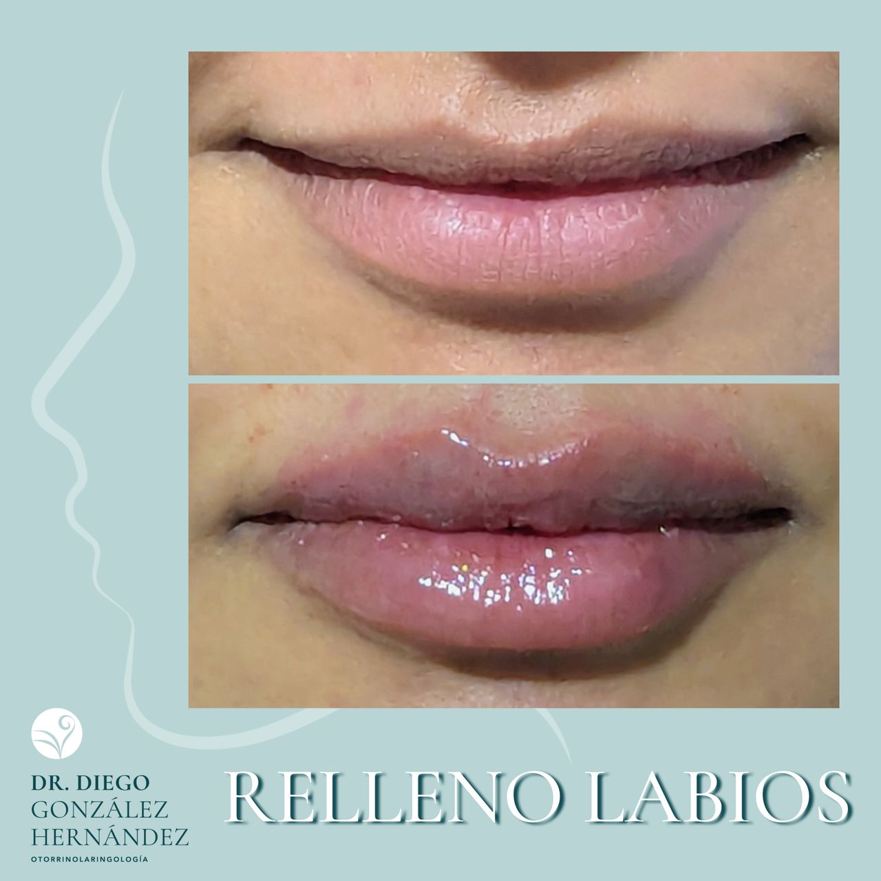 Diego González Hernández-0