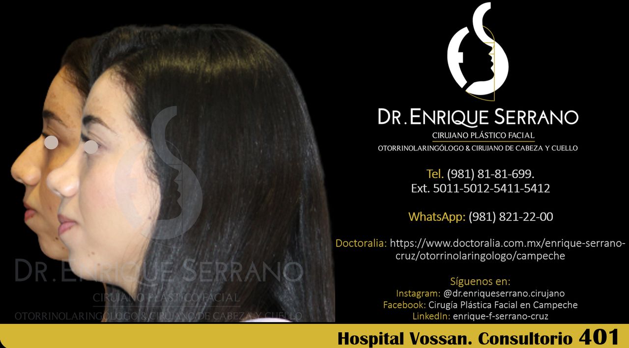 Enrique Serrano Cruz-143