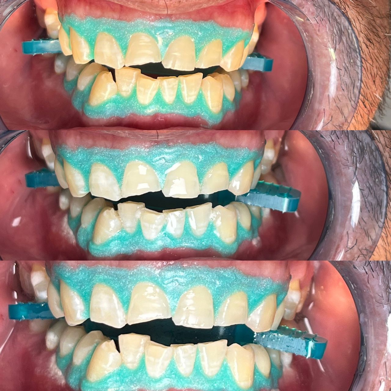 Luis Ángel Ortiz López-3