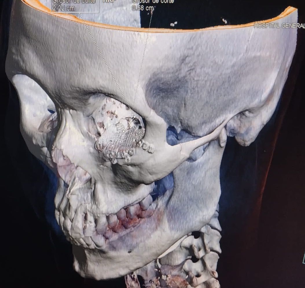 Marco Antonio Martinez Vasquez-6