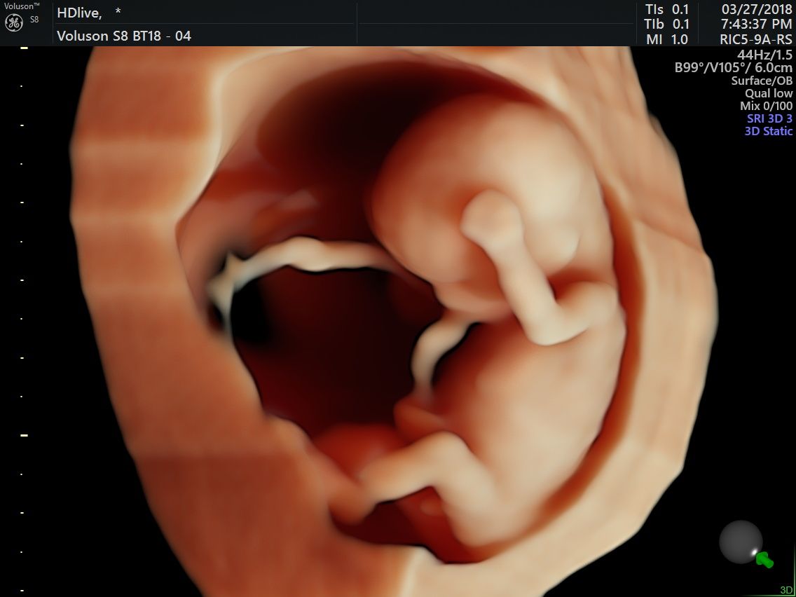 Kenia Militzi Ramírez Campos-9