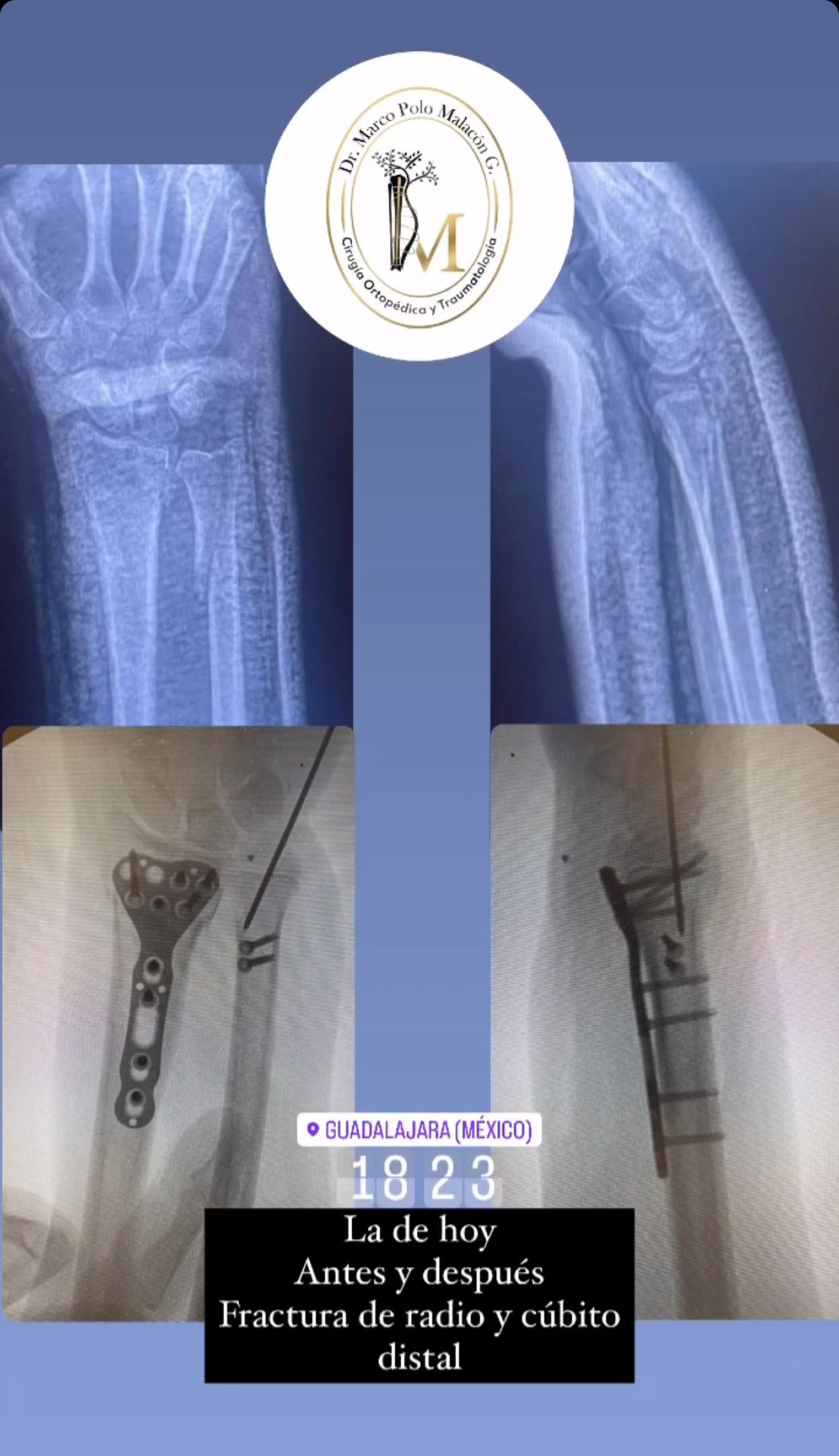 Marco Polo Malacón Gutiérrez-20