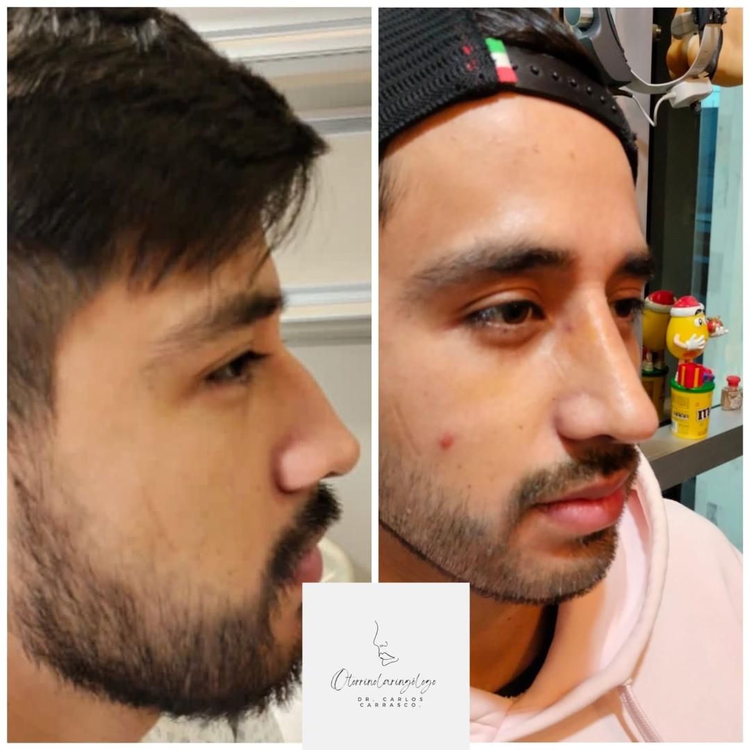 Carlos Alberto Rodriguez Carrasco-2