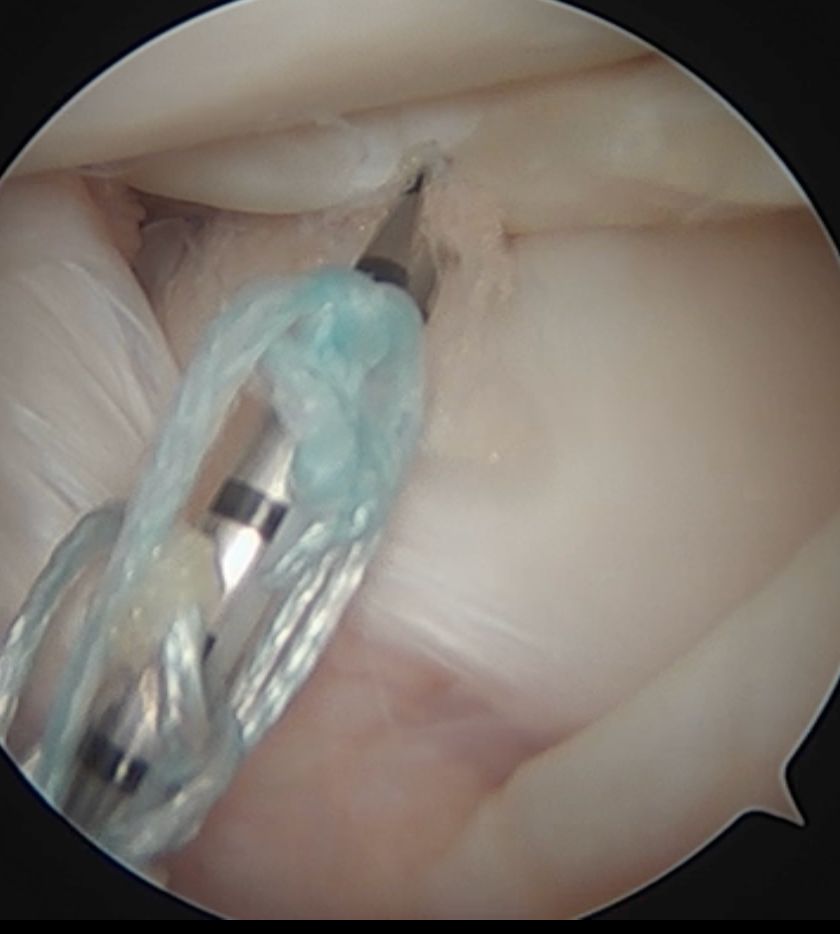 Carlos Ignacio Muñoz Valadez-36