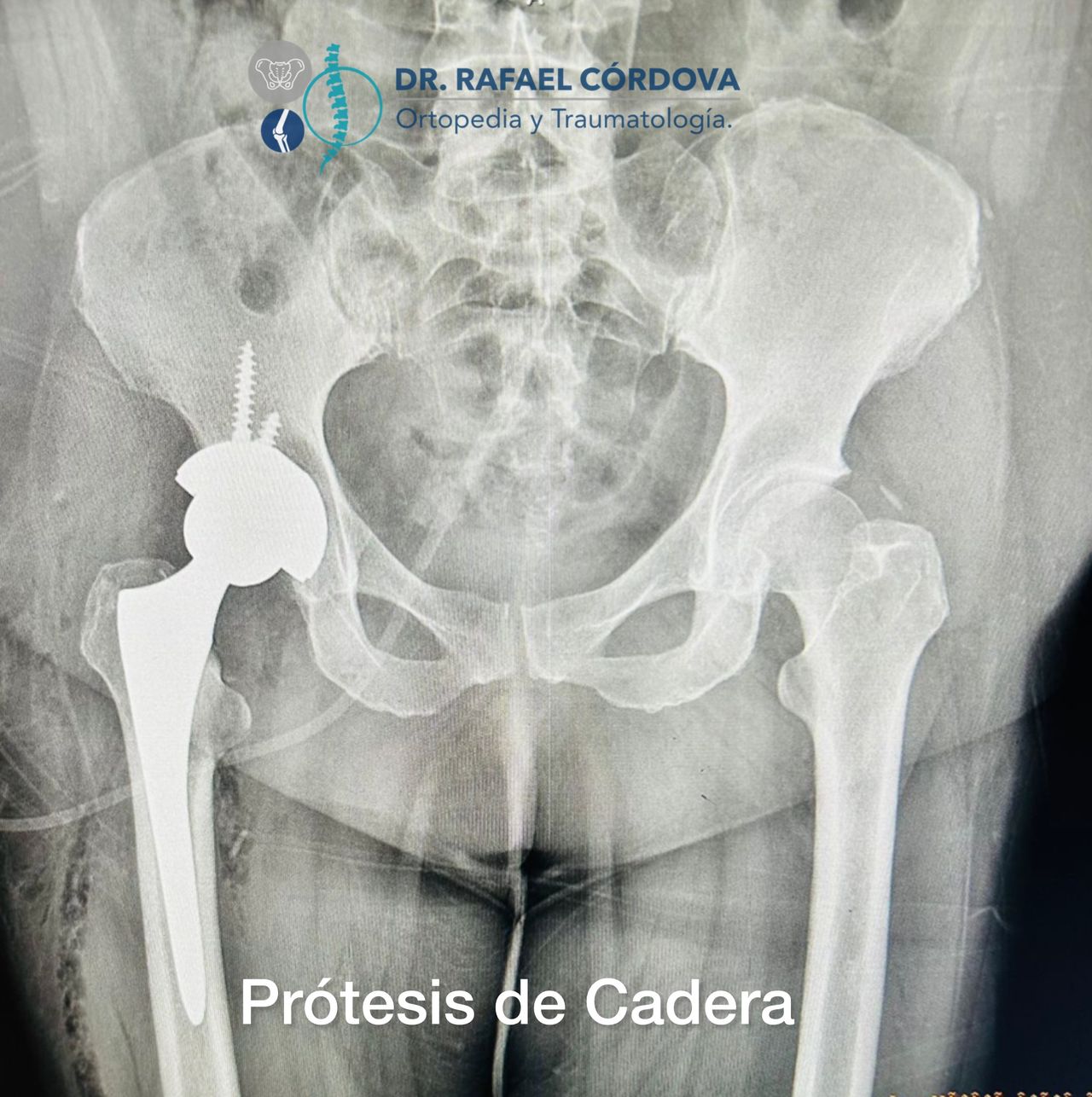 Rafael Córdova Rentería-11