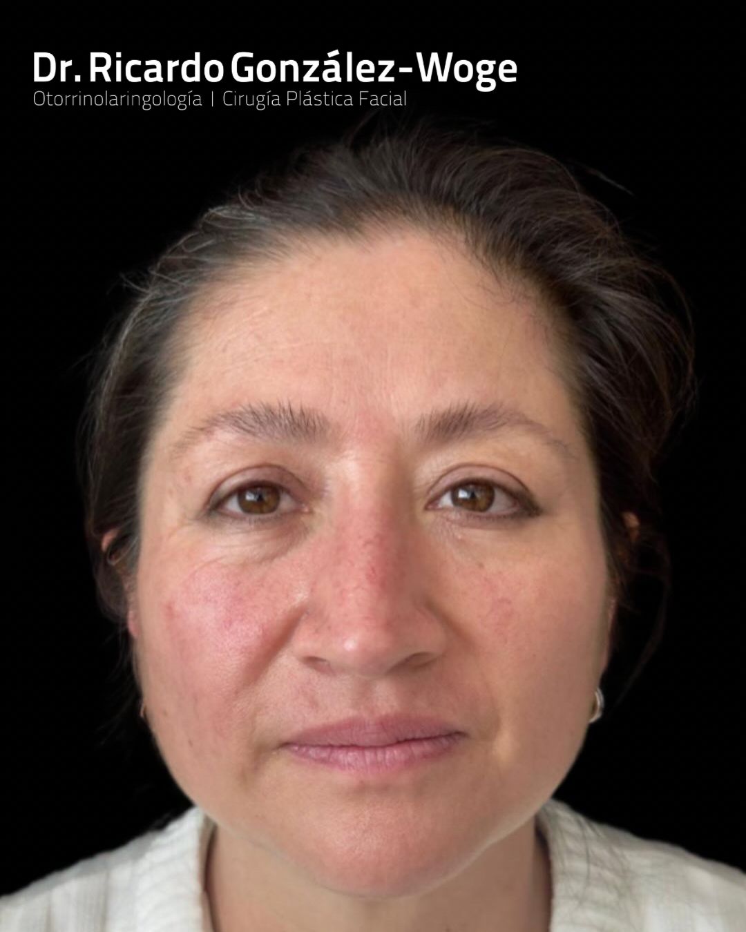 Ricardo Gonzalez Woge-17