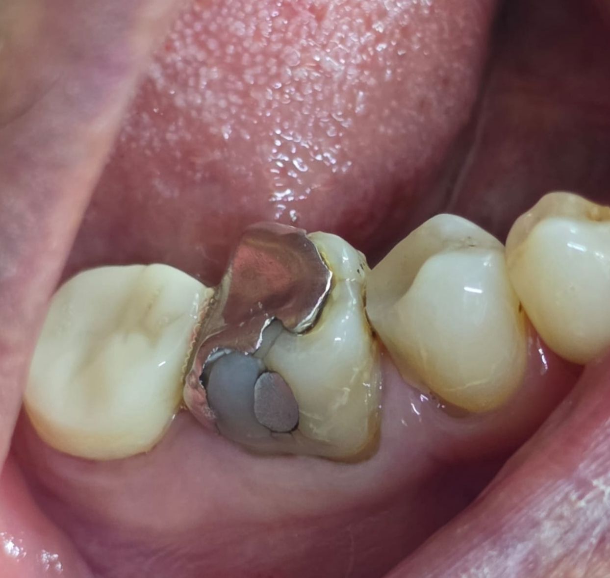 Edgardo Caballero Dávila-21