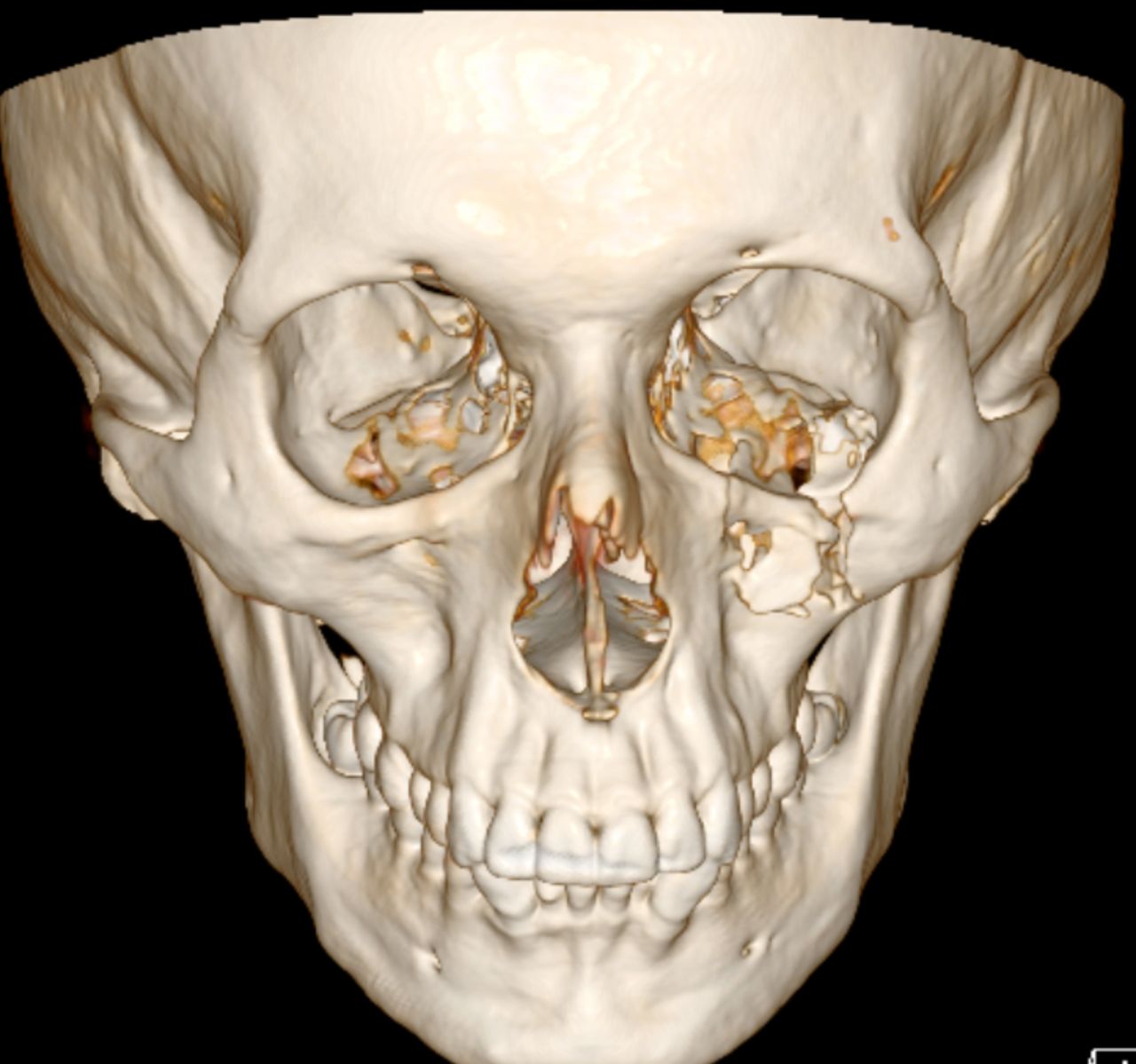 Marco Antonio Martinez Vasquez-4