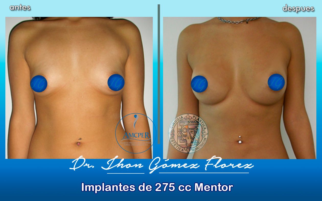 Jhon César Gómez Florez-35