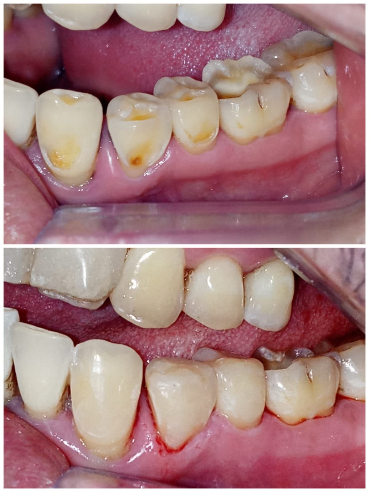 Zury Sarai Moreno Soto-24