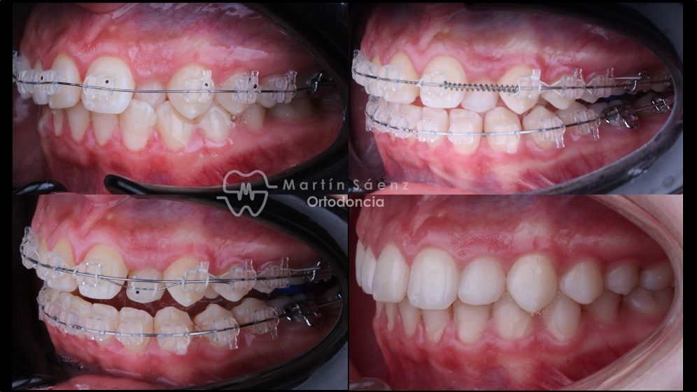 Martín Sáenz Zárate-16