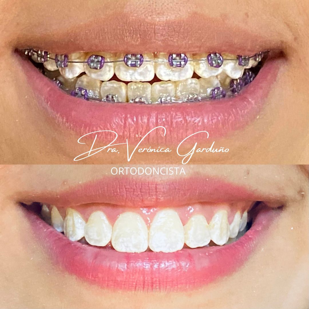 Nayeli Garcia Morales-13