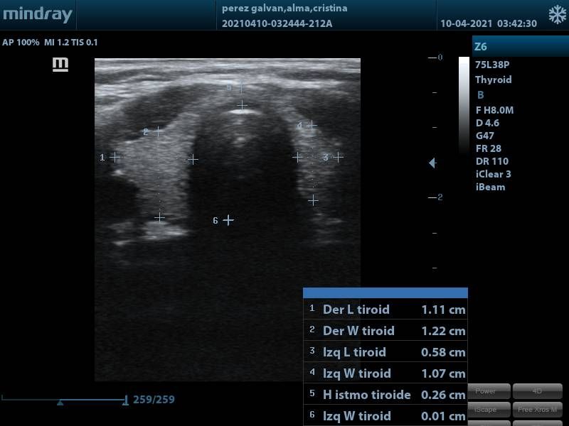 Alma Pérez Galván-8