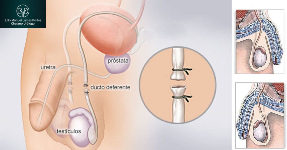 Julio Manuel Lamas Fortes-1