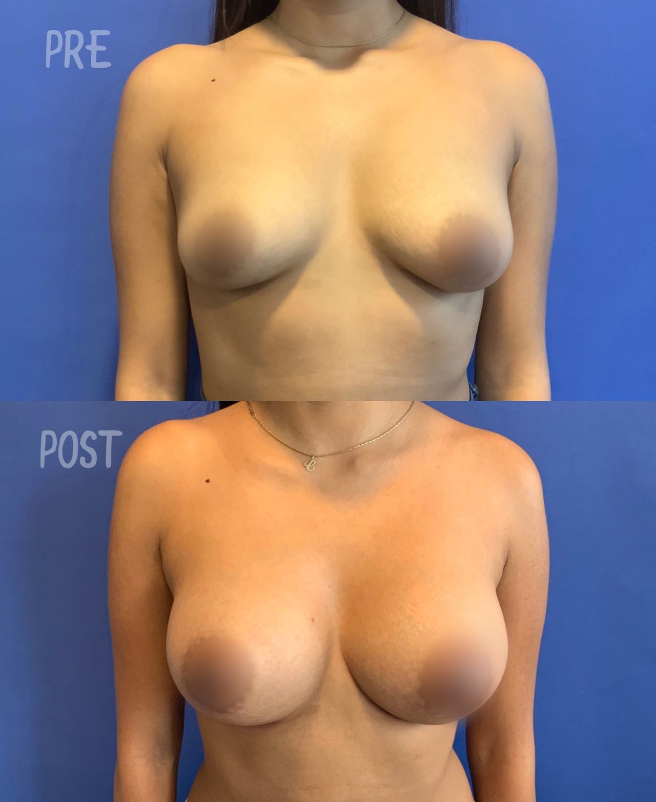 Giuseppe Tanzillo-46