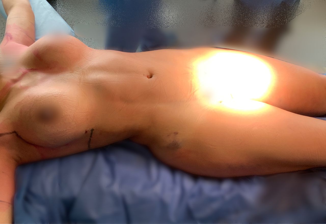 Giuseppe Tanzillo-41