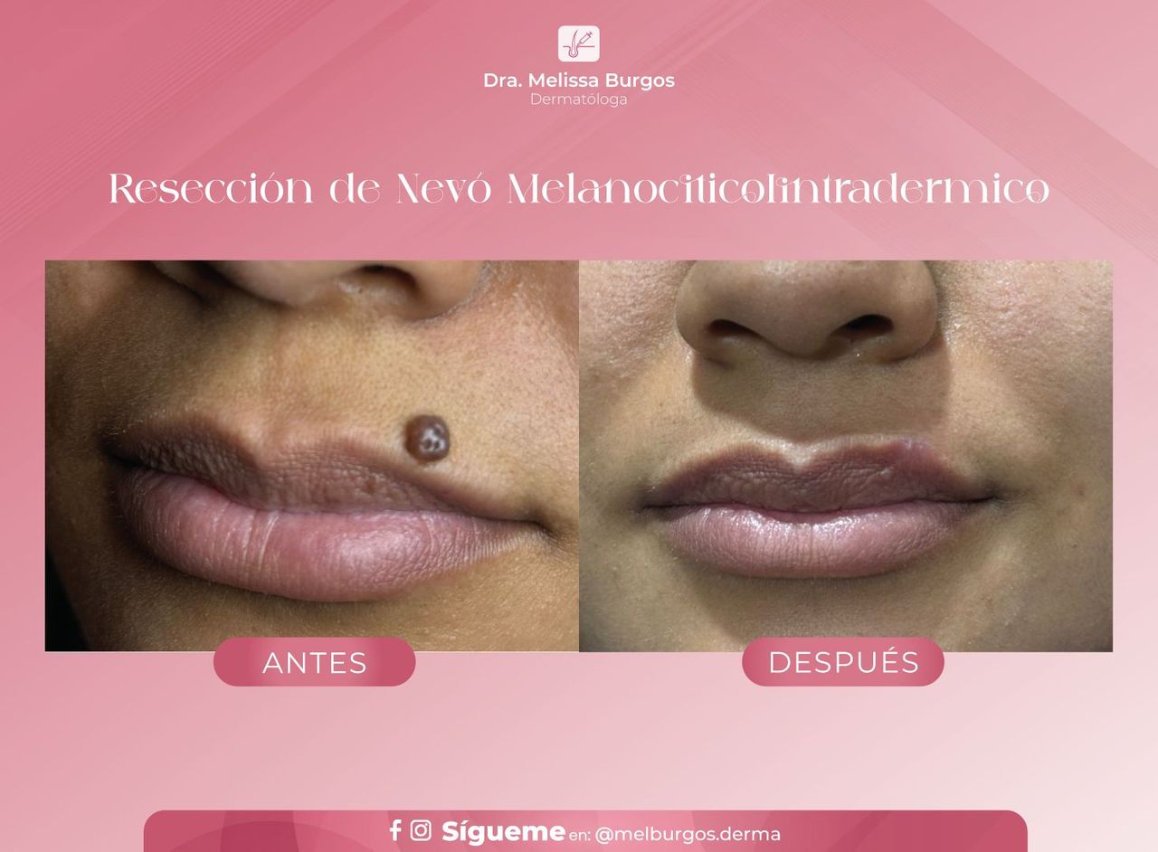 Melissa Burgos Romero-11