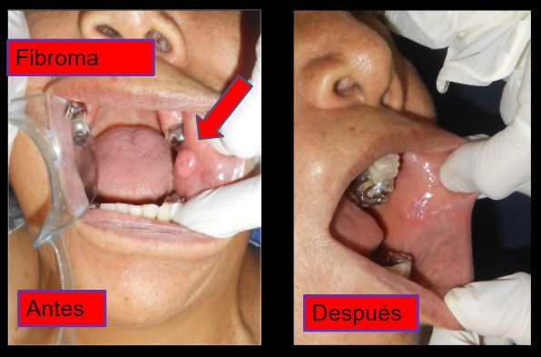 Diana Araceli Dávila Hernández-11