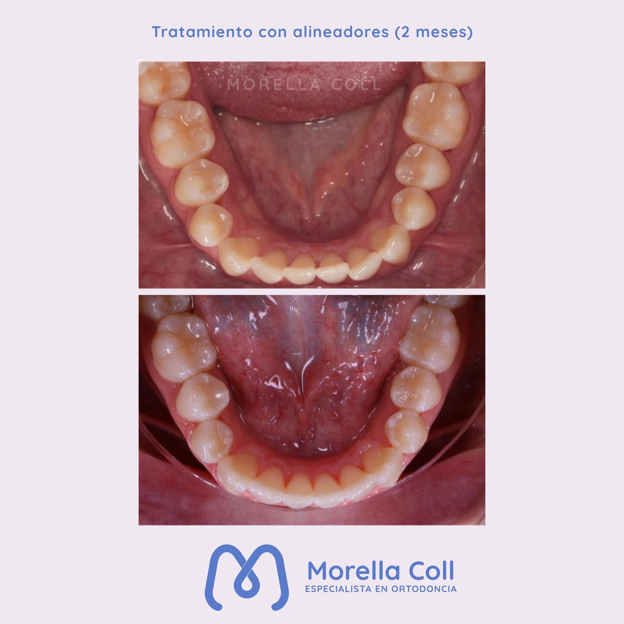 Morella Coll Mibelli-10
