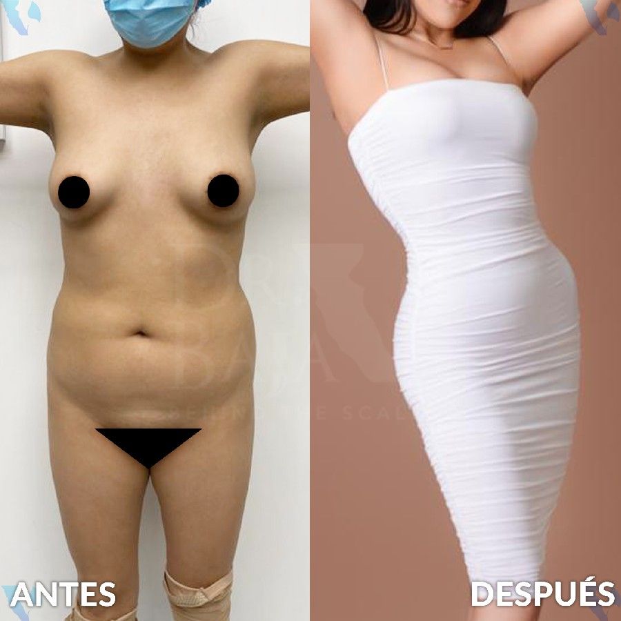 Renato Rodríguez Hirales-39