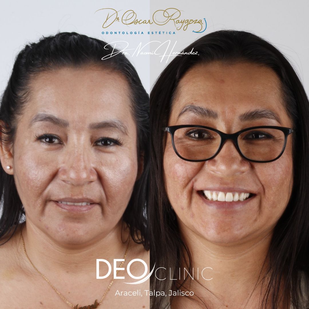 Oscar Raygoza Carrillo-16