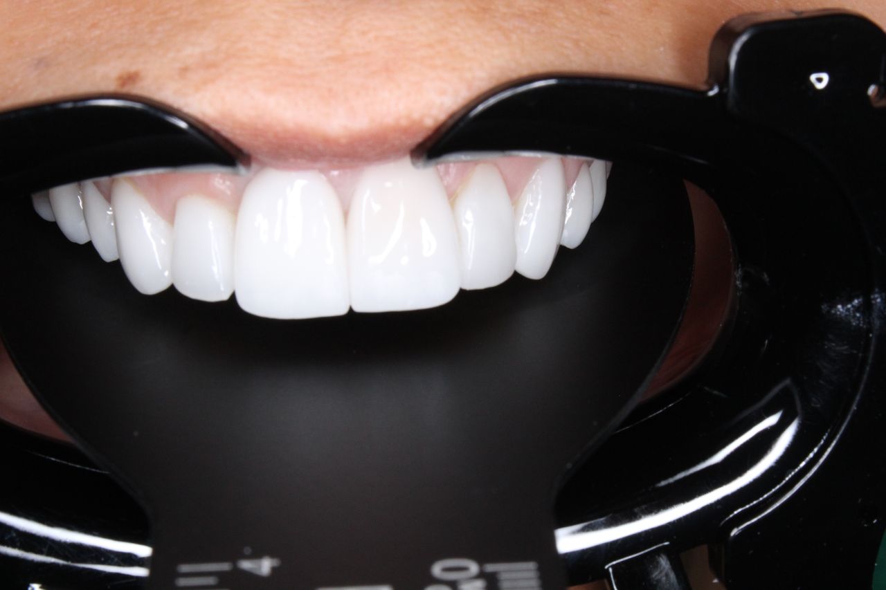 Raul Andrade Martínez-0