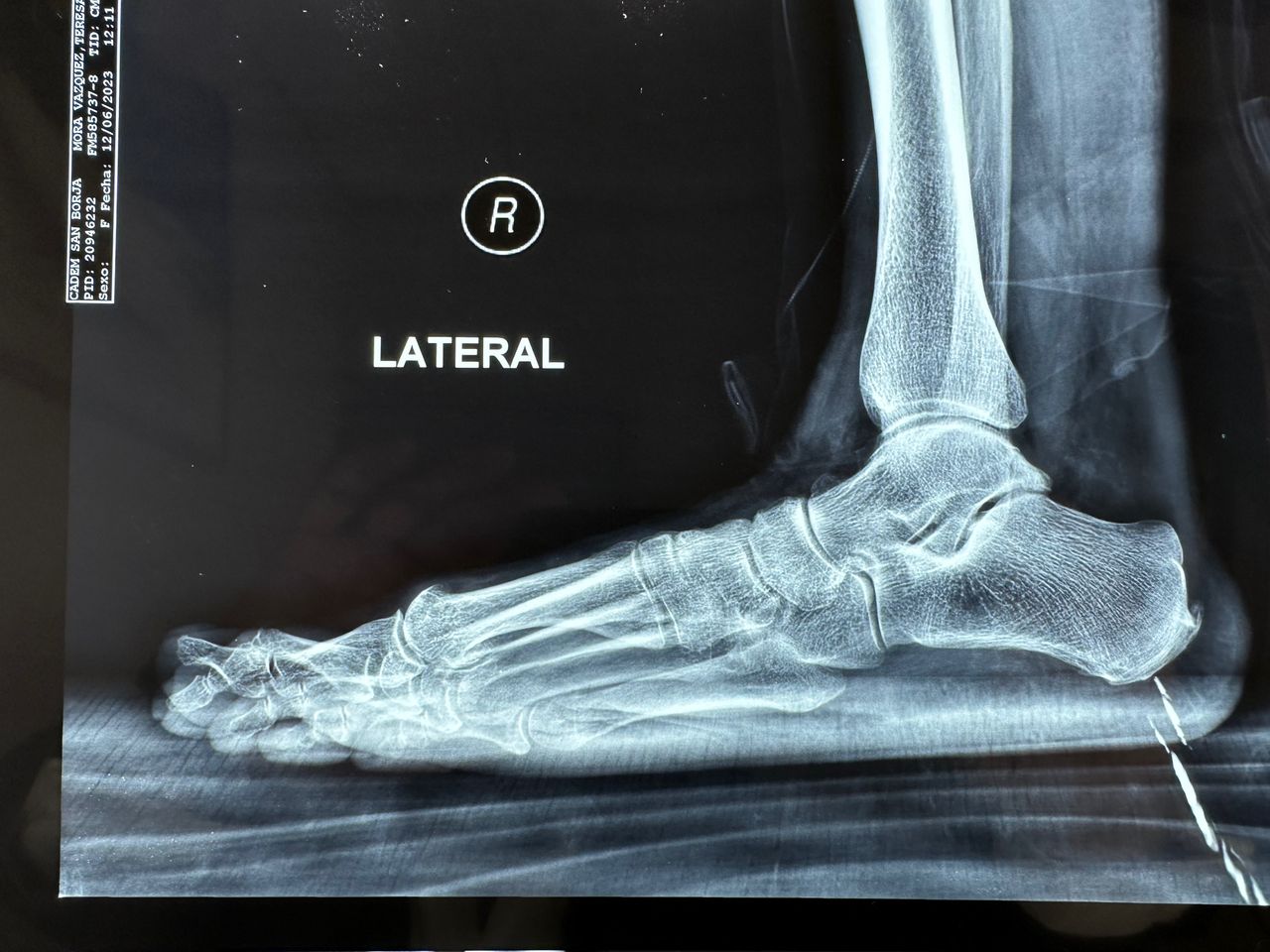 Carlos Ignacio Muñoz Valadez-14