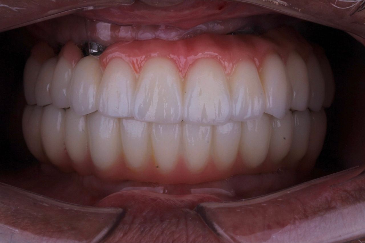 Josué Márquez Gómez-65