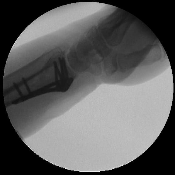 Rafael Adolfo Ferreyra Martinez-8