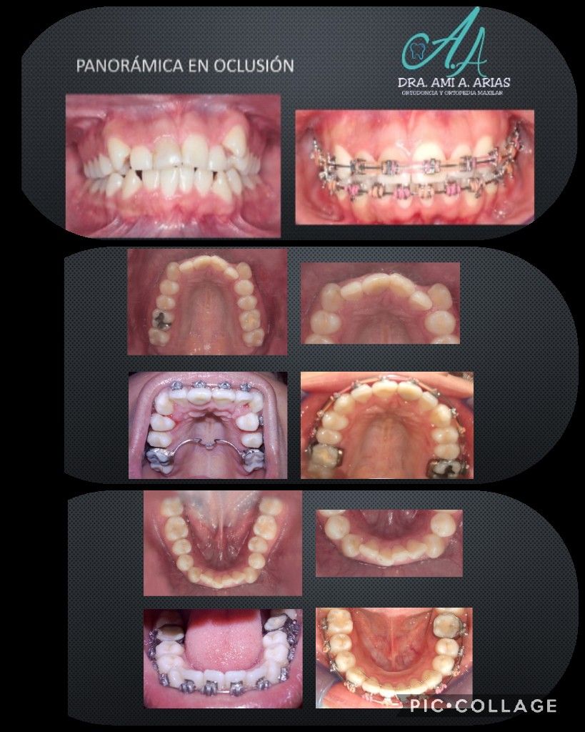 Ami A. Arias Morales-0
