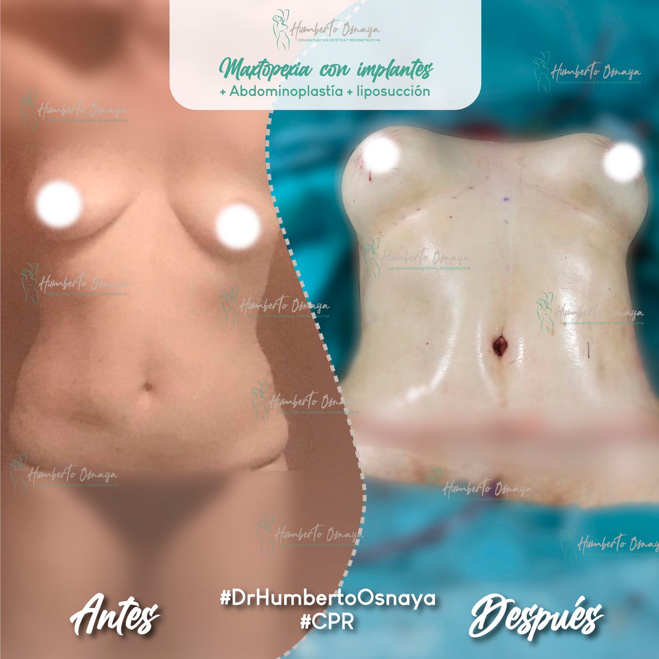 Humberto Osnaya Moreno-29